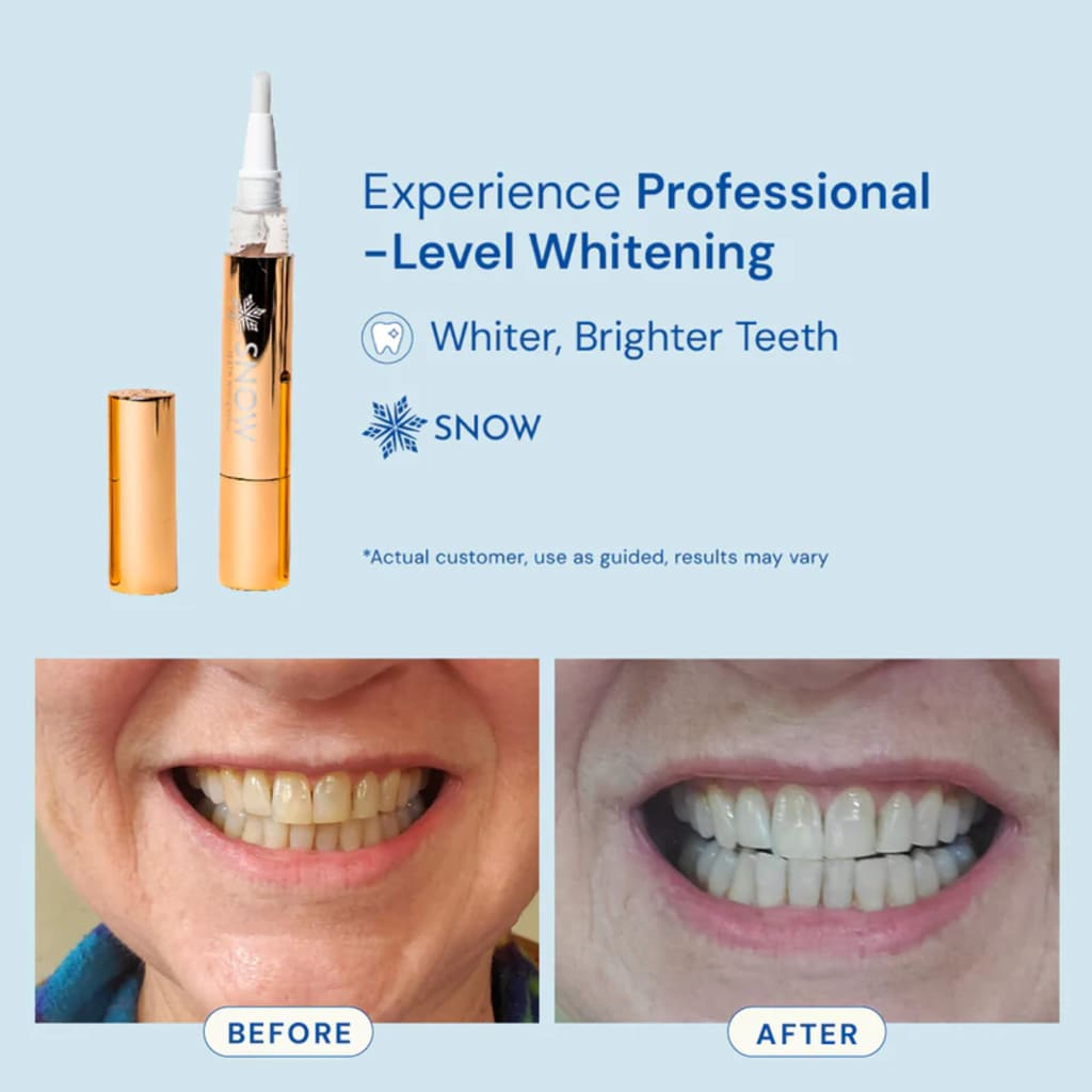 Extra-Strength Whitening Gold Serum Pen Dual-Peroxide Formula