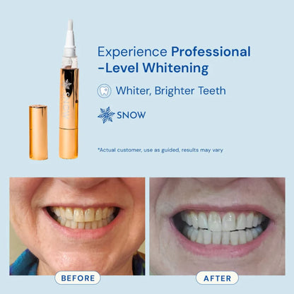 Extra-Strength Whitening Gold Serum Pen Dual-Peroxide Formula
