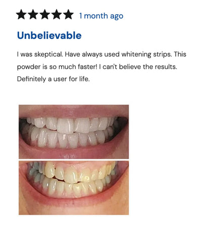 Extra-Strength Whitening Gold Serum Pen Dual-Peroxide Formula