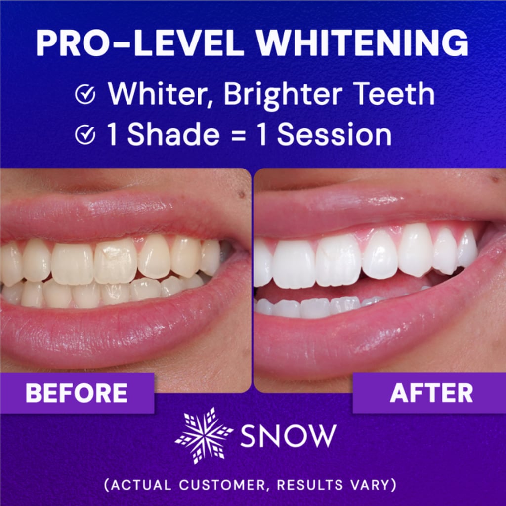 Extra-Strength Whitening Gold Serum Pen Dual-Peroxide Formula