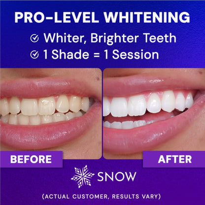Extra-Strength Whitening Gold Serum Pen Dual-Peroxide Formula